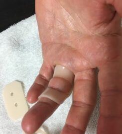 Hand Therapy & Occupational Fitness Center